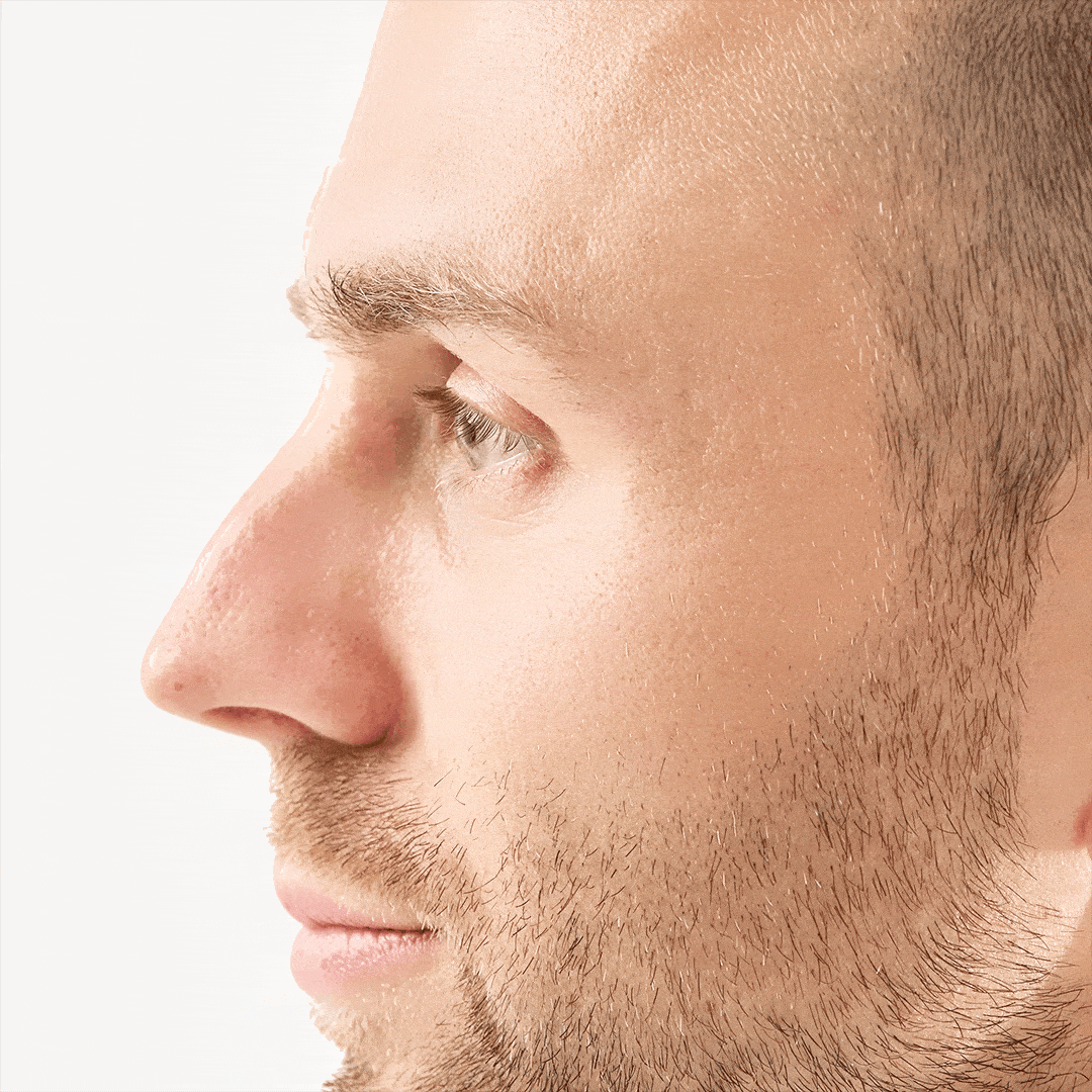 The Science Behind Hydrocolloid Pimple Patches