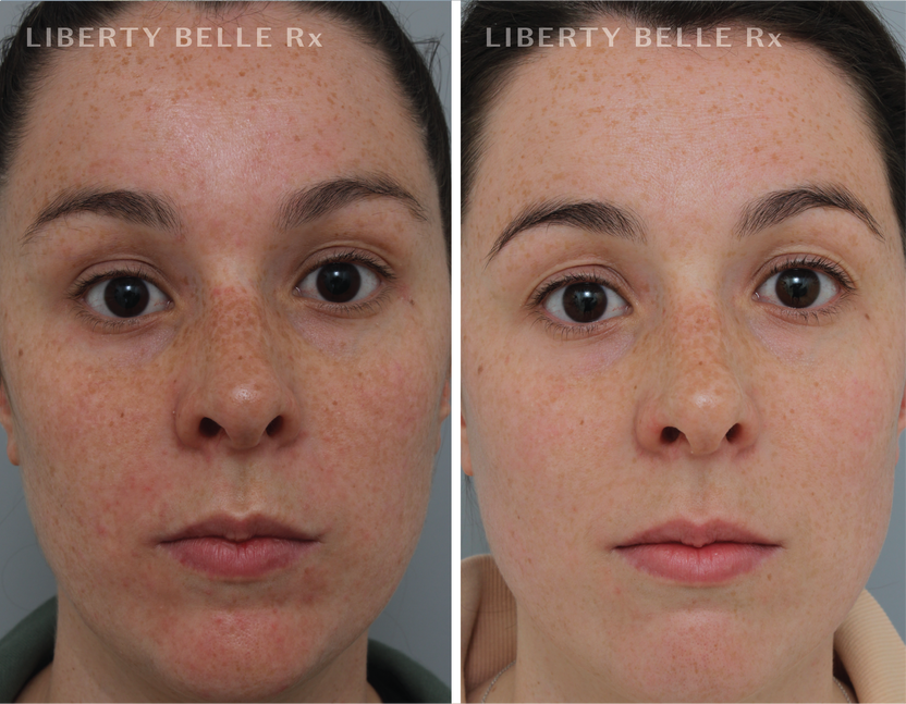 EMILY M | Liberty Belle Rx