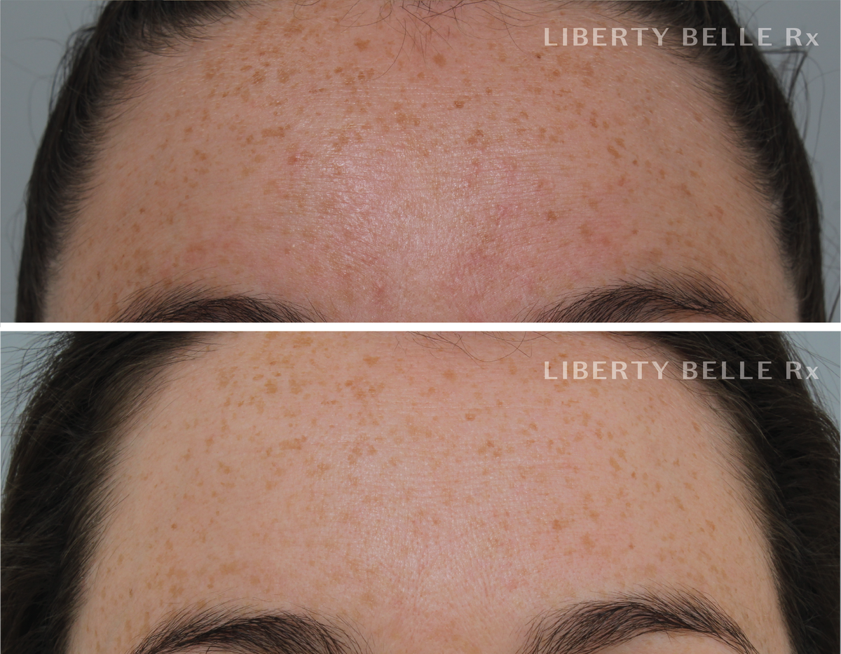 EMILY M | Liberty Belle Rx