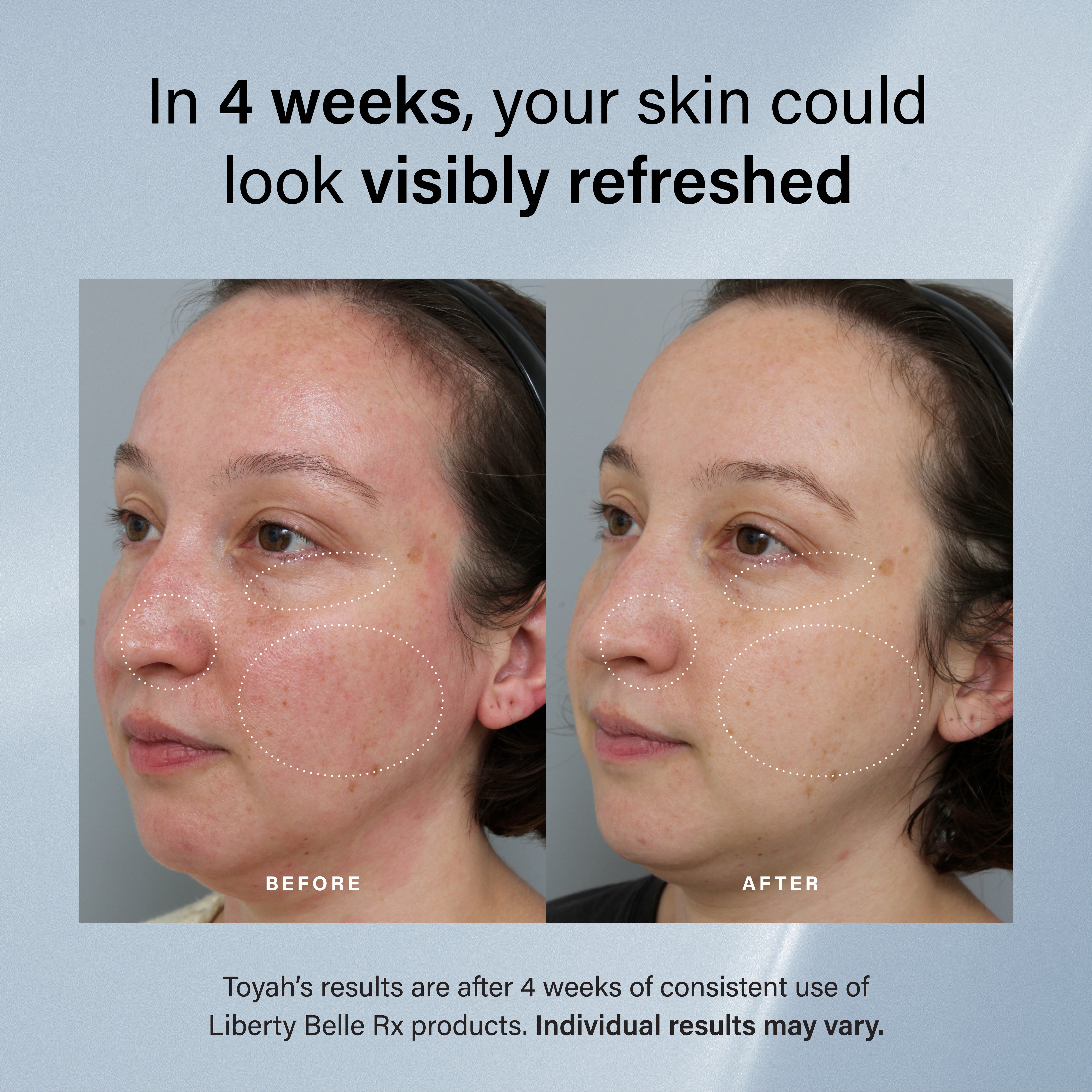 The Mini Starter Set