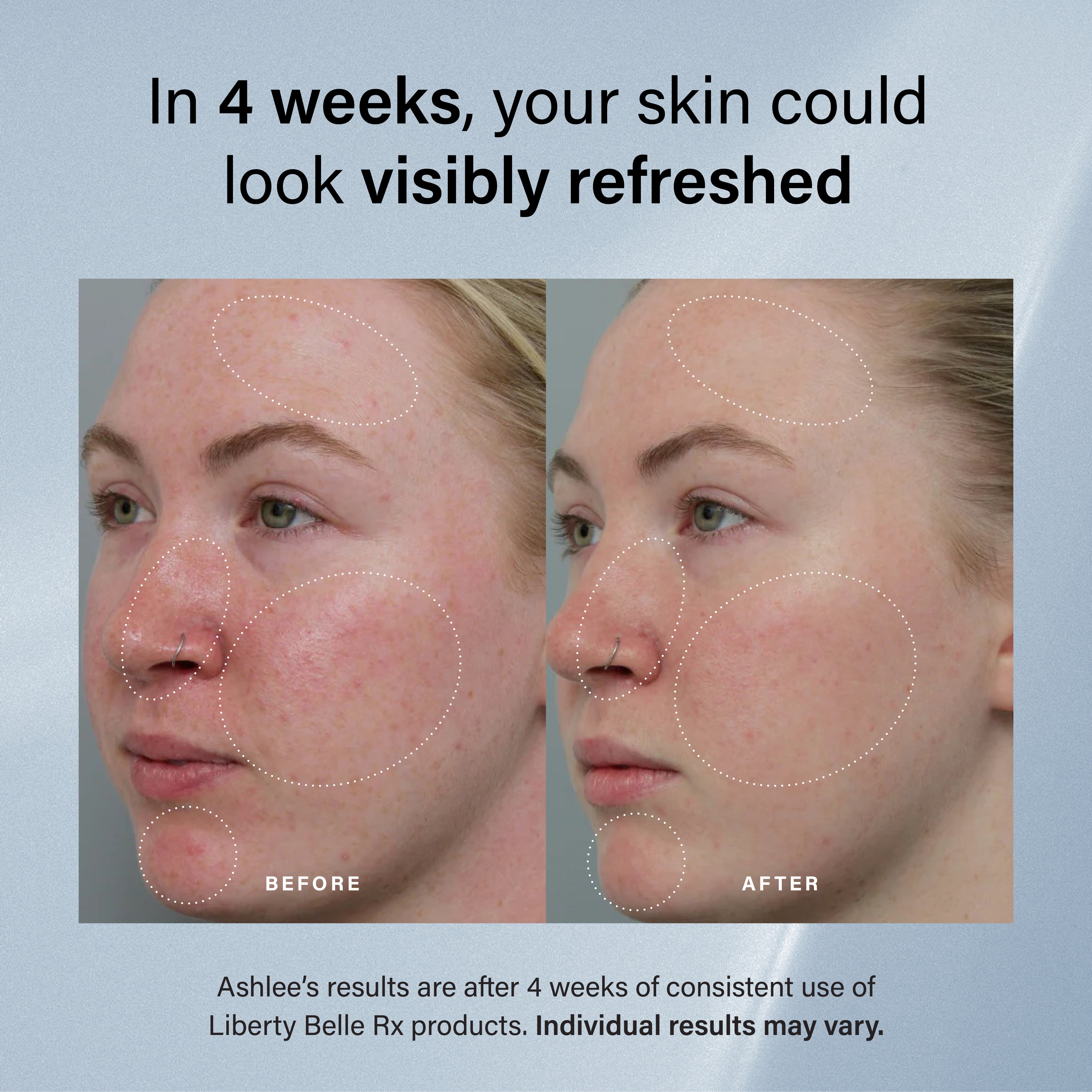 The Mini Starter Set