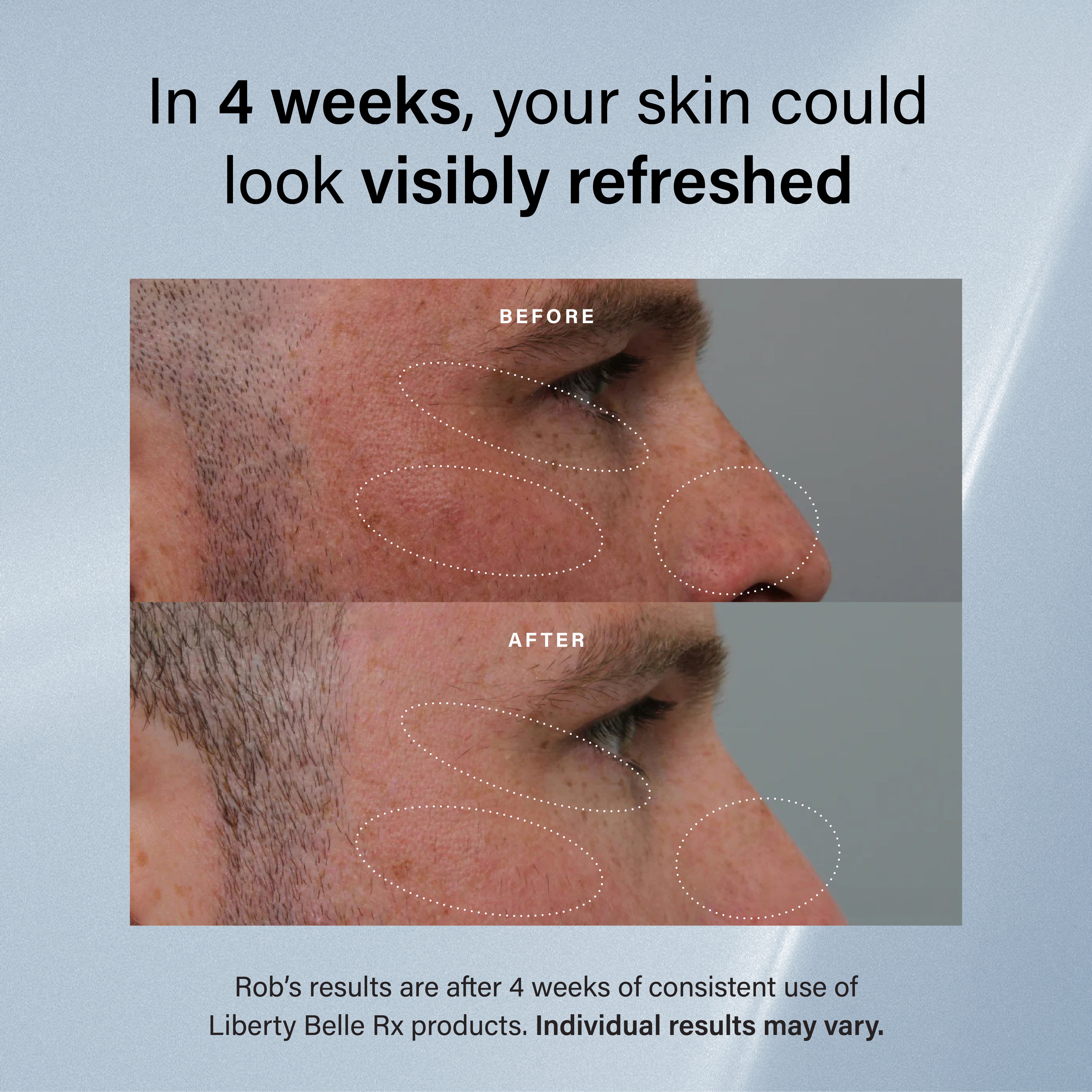 The Mini Starter Set