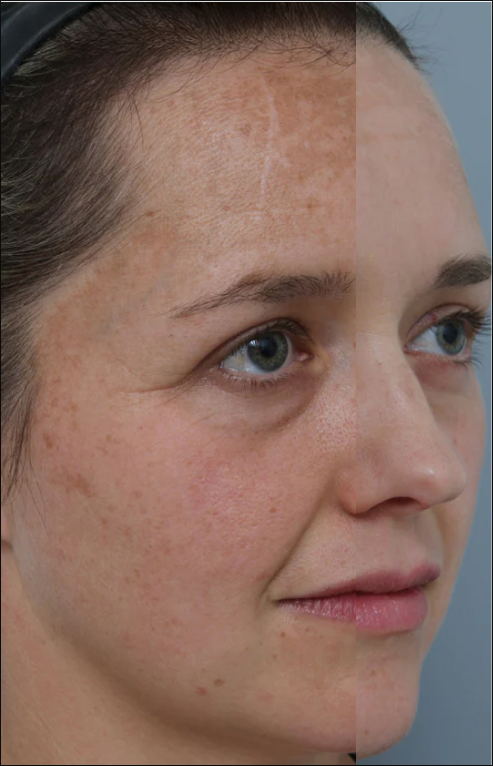 Explore our Before and After results