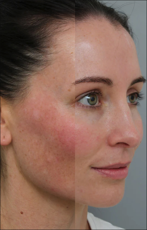 Explore our Before and After results