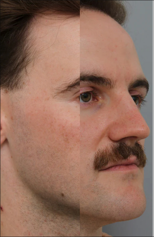 Explore our Before and After results